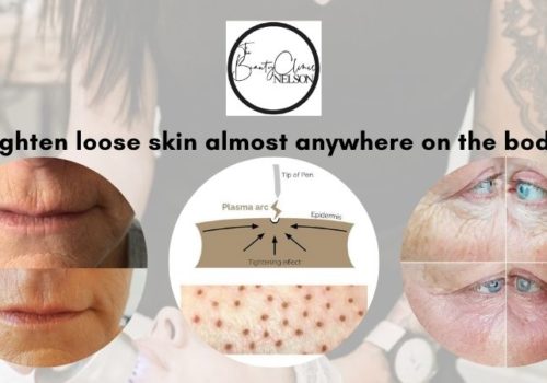 Tighten Loose Skin Almost Anywhere On The Body!