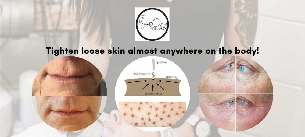 Tighten Loose Skin Almost Anywhere On The Body!