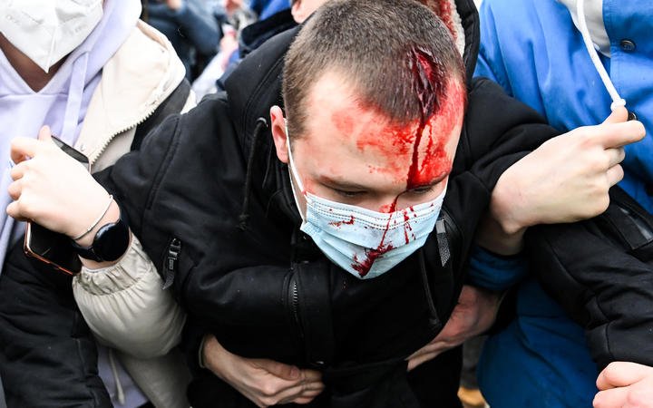 An injured man is helped by other protesters during a rally in support of jailed opposition leader Alexei Navalny in downtown Moscow on January 23, 2021. -