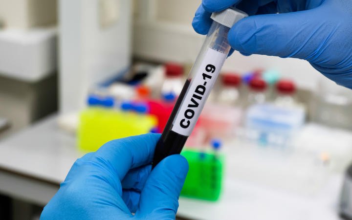 Blood test for COVID-19. Examination of a blood sample for the presence of SARS-CoV-2 coronavirus.